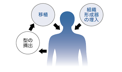 生体内組織形成術（iBTA<sup>®</sup>）