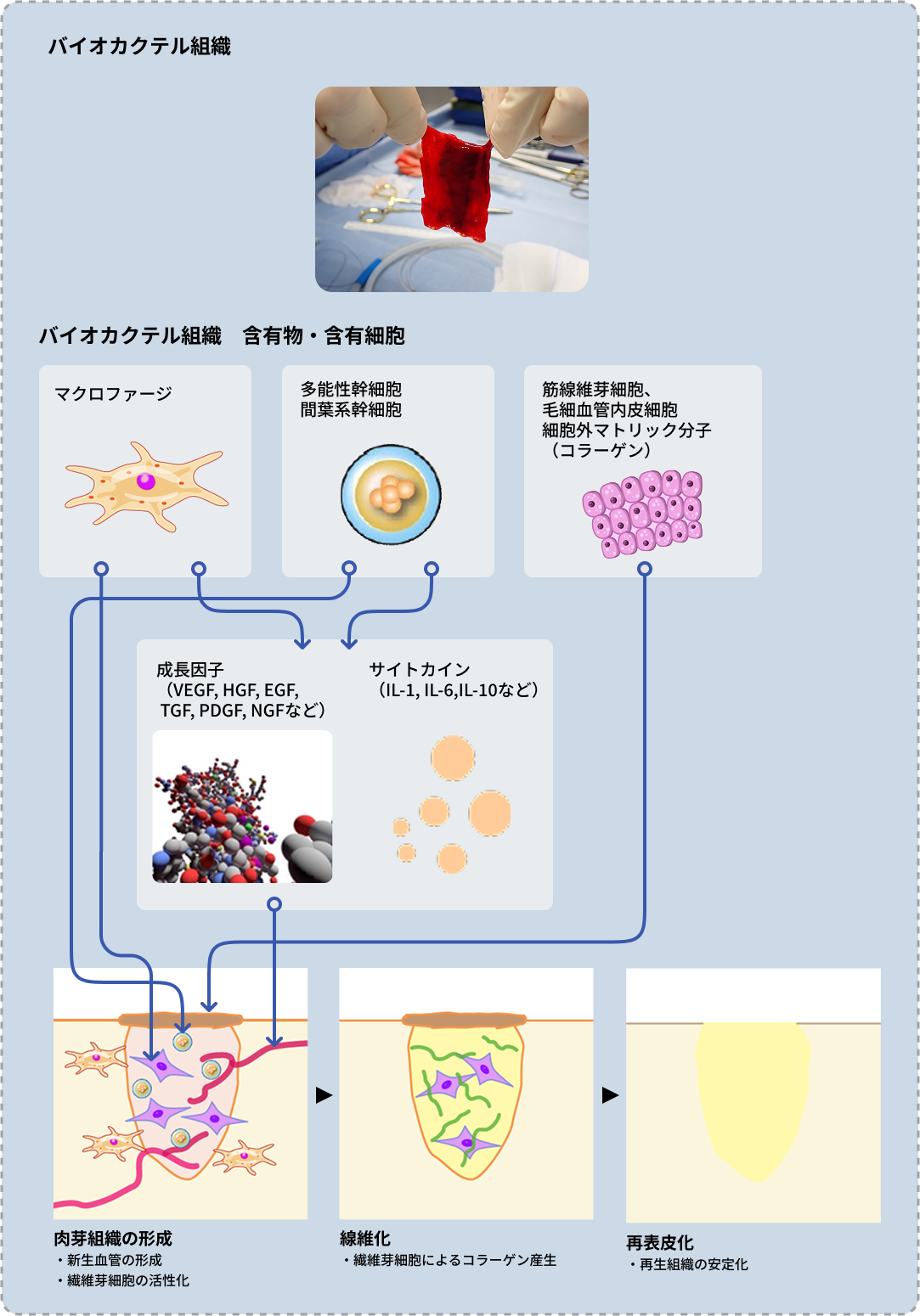 バイオカクテル組織の治療メカニズム（糖尿病性足潰瘍）