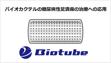 バイオカクテルの糖尿病性足潰瘍の治療への応用