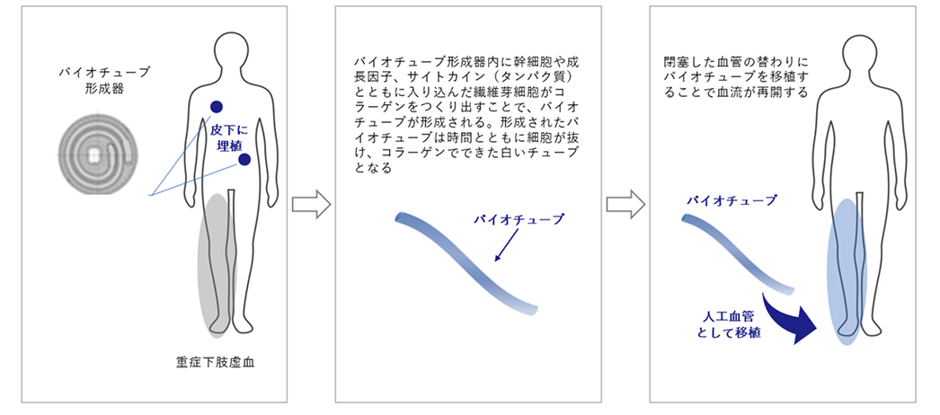 バイオチューブ組織の治療メカニズム（重症下肢虚血）